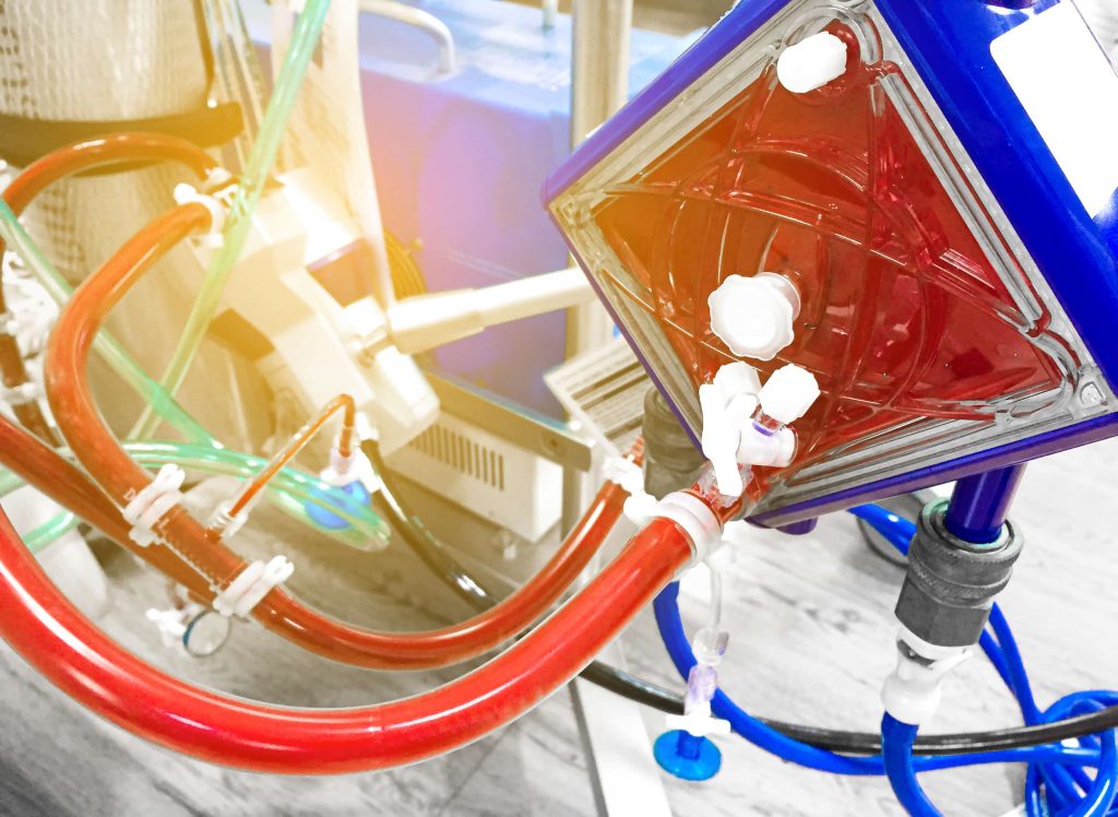 Liver Perfusion Machine Boosts South Africa's Transplant Care
